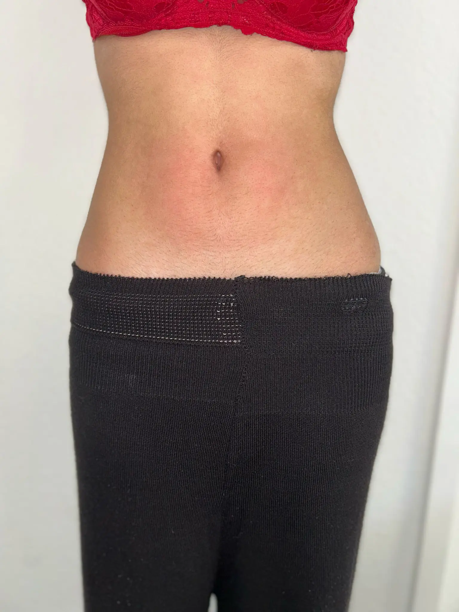 Bauch und Taille als Beispiel für eine Bodyforming-Wunschzone