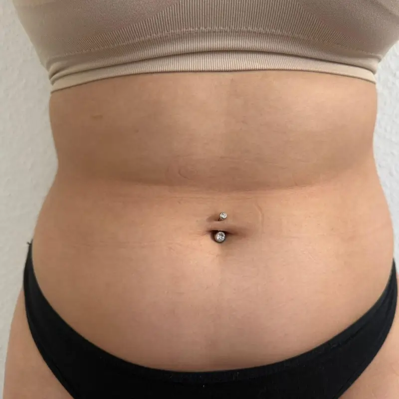 after (4) (1) after (4) (1)