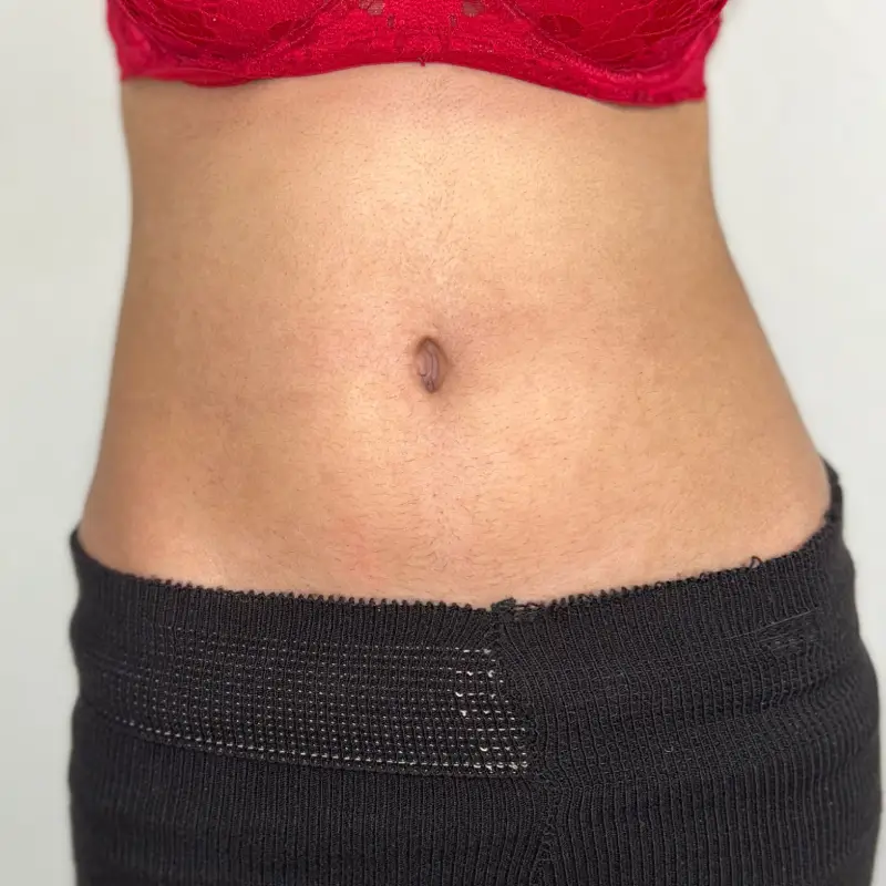 before (5) (1) before (5) (1)