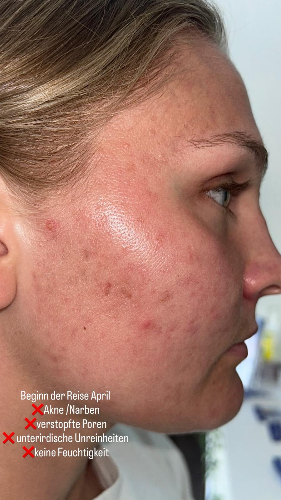 vorher1.jpeg vorher1.jpeg