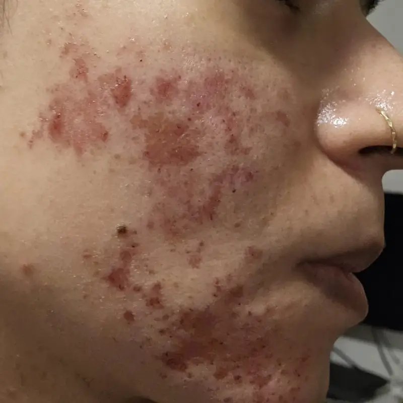 vorher3.11 (1) vorher3.11 (1)